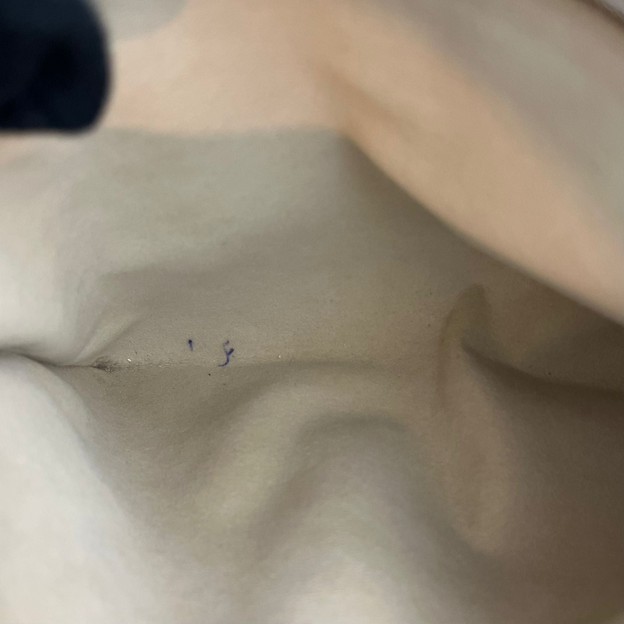 Louis Vuitton Hampstead MM Damier Azur